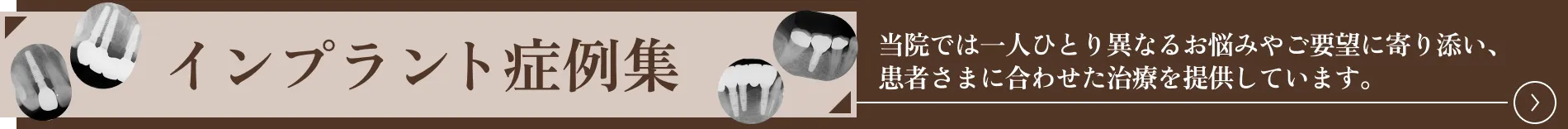 インプラント症例集はこちら